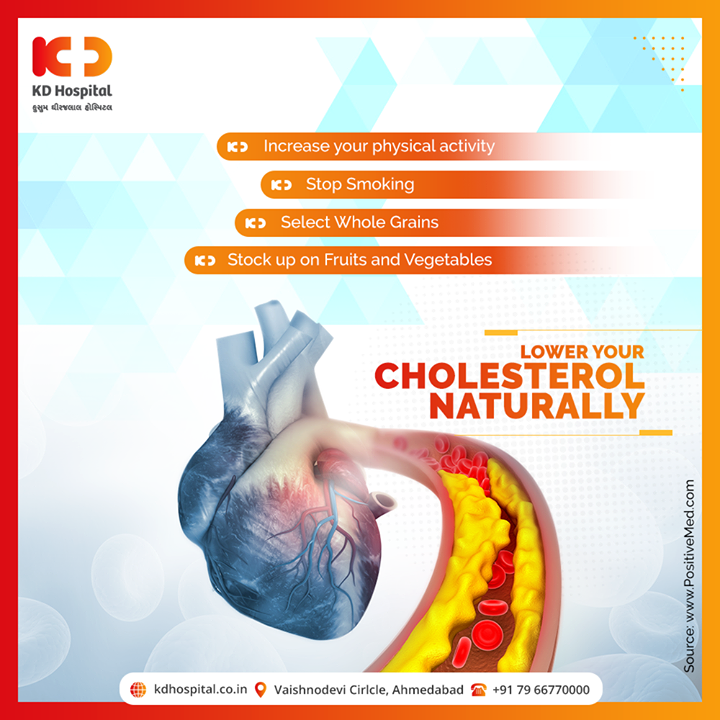 It's Important to commit to a lifestyle change if you want to improve your Cholesterol Level. These four simple ways will help you Lower your Cholesterol Naturally. 

#KDHospital #goodhealth #health #wellness #fitness #healthiswealth #healthyliving #patientscare #Ahmedabad #Gujarat #India