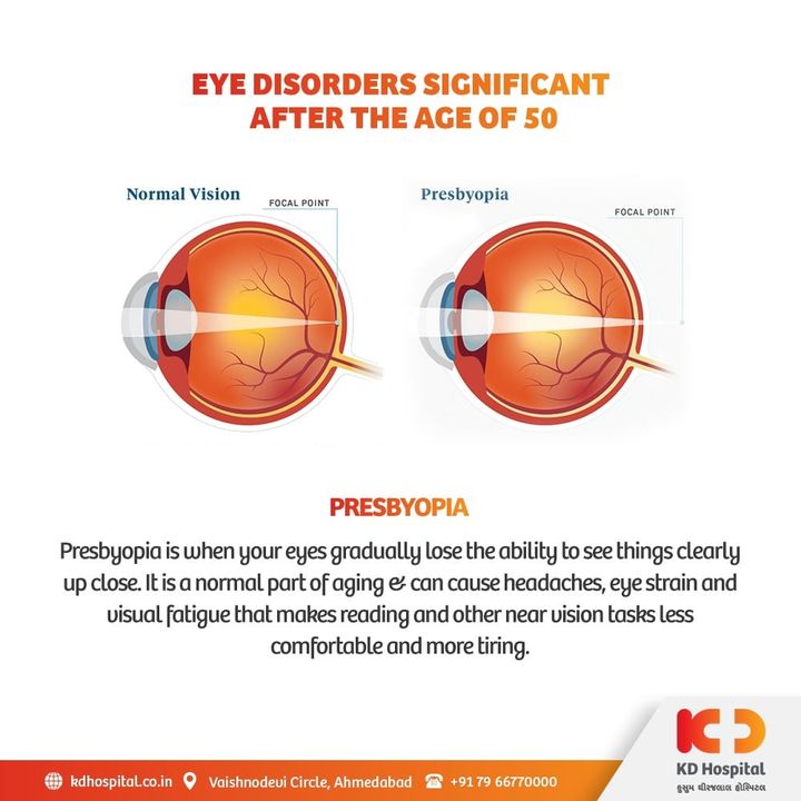 Presbyopia, which is the inability of eyes to focus on nearby objects become evident in the mid-40s, which keeps worsening till late 60s if not diagnosed and treated promptly. 

KD Hospital offers a free eye consultation from 17/11/2020 to 30/11/2020 for the patients above the age of 50. Call +918980280802 or +916359603634 between 9:00 AM to 5:00 PM to book an appointment. Additionally, we have Cashless Facilities available at the hospital.

#KDHospital #eyecheckup #Presbyopia #blindness #blind #cataractsurgery #blindnessawareness #DoctorsOfInstagram #Diagnosis #Therapeutics #goodhealth #pandemic #socialmedia #socialmediamarketing #digitalmarketing #wellness #wellnessthatworks #Ahmedabad #Gujarat #India