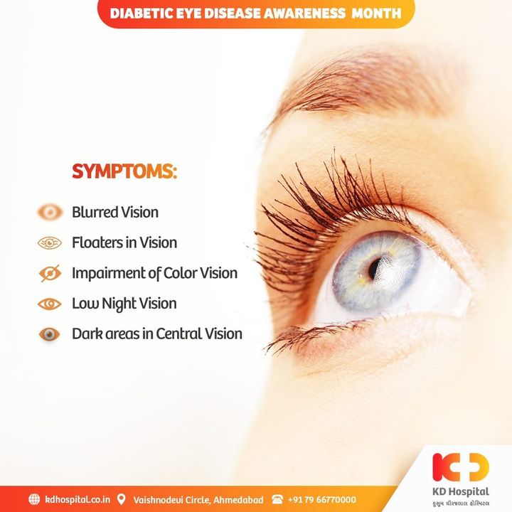 Diabetic Eye Disease Awareness Month focuses on preventing visual impairment to educate society on the impacts of diabetes on vision, hazard variables, and treatment choices.

Be part of our ongoing campaign of Free Eye Consultation (By Prior Appointment Only) at KD Hospital, valid till 30/11/2020. Call +918980280802 or +916359603634 between 9:00 AM to 5:00 PM to book an appointment.

#KDHospital #MultiSpecialtyHospital #DiabeticEyeDisease #eyedisease #eyedonation #PreventBlindness #HopeInSight #DoctorsOfInstagram #Diagnosis #Therapeutics #goodhealth #pandemic #socialmedia #socialmediamarketing #wellness #wellnessthatworks #Ahmedabad #Gujarat #India