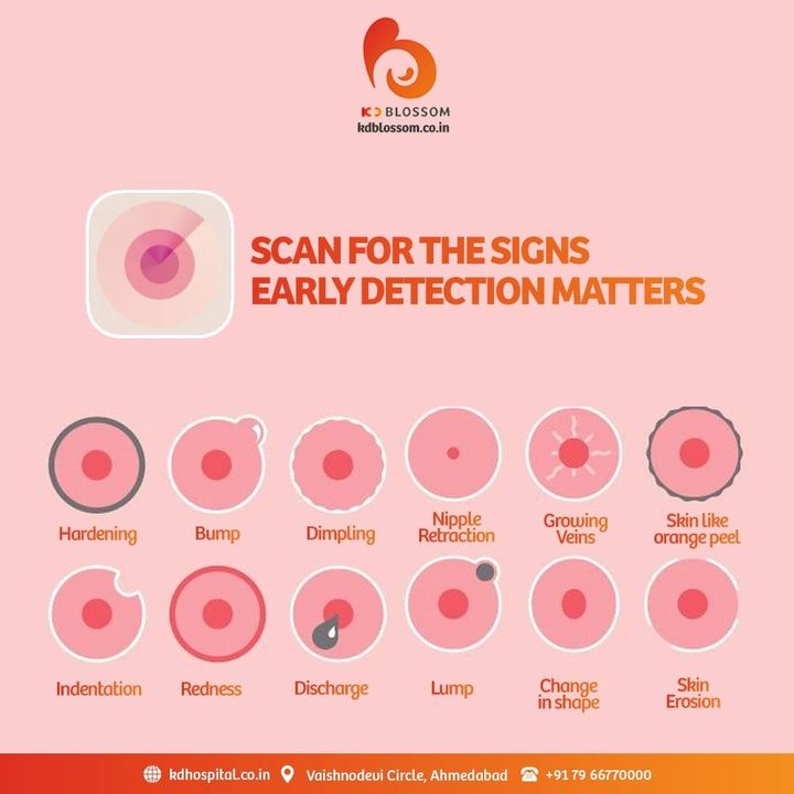 Regular Breast Self-Examination (BSE) not only screens for possible irregularities, but also helps to detect the possibility of breast cancer. We all should take up BSE at least once a month.
#KDHospital #KDBlossom #breastcancerawareness #breastcancer #breastcancersurvivor  #Cancer #CancerFree #cancersurvivor #breastcancerfighter #breastcancerjourney #StayAware #StayAwareStaySafe  #Diagnosis #goodhealth #pandemic #socialmedia #socialmediamarketing #digitalmarketing #wellness #wellnessthatworks #Ahmedabad #Gujarat #India