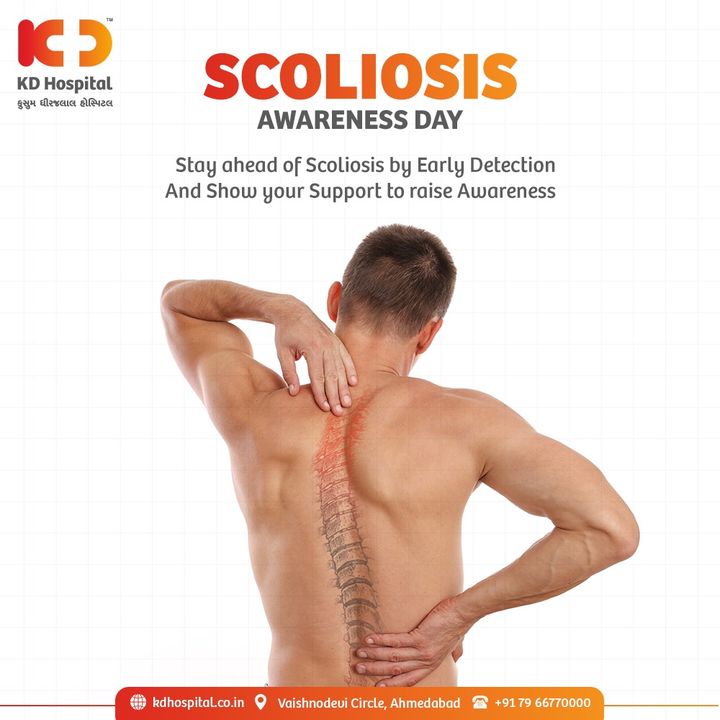 Scoliosis is a spinal deformity that affects one’s appearance and posture. Lets spread awareness about early detection on this day.

#KDHospital #Scoliosis #ScoliosisAwarenessDay #Detection #Diagnosis #Therapeutics #Awareness #wellness #goodhealth #wellnessthatworks #Nursing #NABHHospital #QualityCare #hospitals #healthcare #physicians #explore #surgeon #Ahmedabad #Gujarat #India