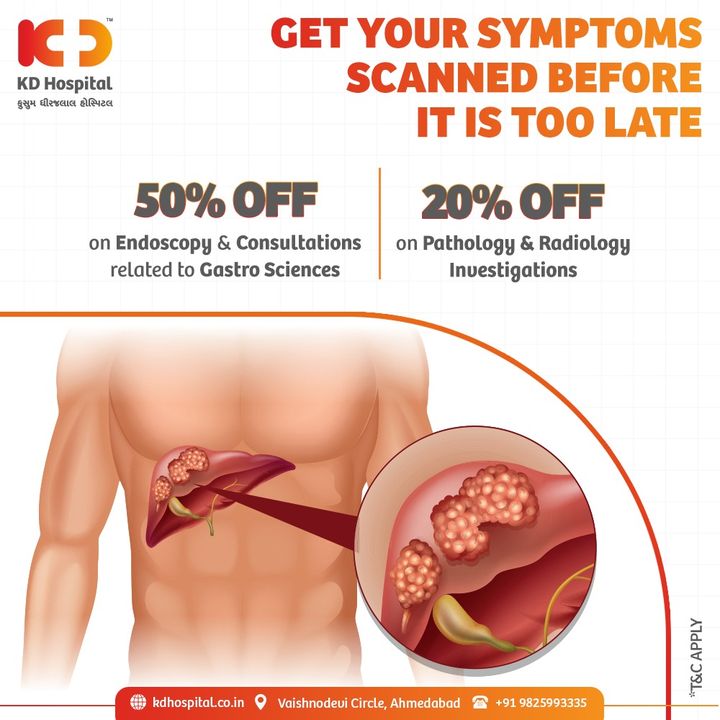 Live Liver Cancer free by watching out for these symptoms including Weight loss, Stomach pain, Vomiting and Yellowish skin. Get them scanned before cancer starts developing outside the Liver and starts spreading to other Organs.

Call +919825993335 to book an appointment with us.

#KDHospital #GastroSciences #GastroEnterology #GastroSurgery #LiverDiseases #LiverCancer #Liver #Safety #PatientSafety #SafetyMeasures #Diagnosis #Therapeutics #Awareness #wellness #goodhealth #wellnessthatworks #Nusring #NABHHospital #QualityCare #hospital #explore #healthcare #physicians #surgeon #Ahmedabad #Gujarat #India