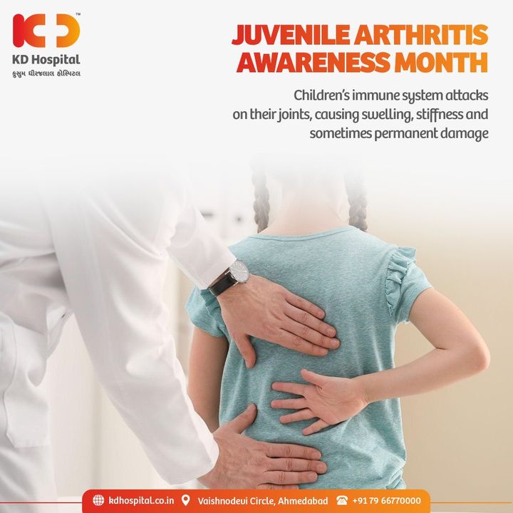 Juvenile Arthritis is caused by inflammation in the joints & causes pain, swelling, stiffness in the joints. It is a common misconception that only “old” people are affected by arthritis. Arthritis also affects children. 

#KDHospital #Arthritis #JuvenileArthritis  #Detection #Diagnosis #Therapeutics #Awareness #wellness #goodhealth #wellnessthatworks #Nursing #NABHHospital #QualityCare #hospitals #healthcare #physicians #explore #surgeon #Ahmedabad #Gujarat #India