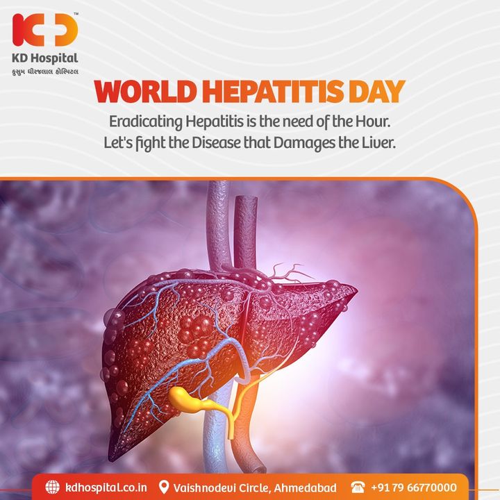 “Hepatitis Can't-Wait”

World Hepatitis Day ensures that all of us take our liver health sincerely to prevent hepatitis and spread the word about it to achieve a hepatitis-free future together. 

Also, KD Hospital is offering concessional rates on Gastroscience Consultation, call +919825993335 to book your appointment. 

#KDHospital #WorldHepatitisDay #Hepatitis #Liver #LiverDiseases #GastroSciences #GastroEnterology #GastroSurgery #Diagnosis #Therapeutics #Awareness #wellness #goodhealth #wellnessthatworks #Nursing #NABHHospital #QualityCare #hospital #explore #healthcare #physicians #surgeon #Ahmedabad #Gujarat