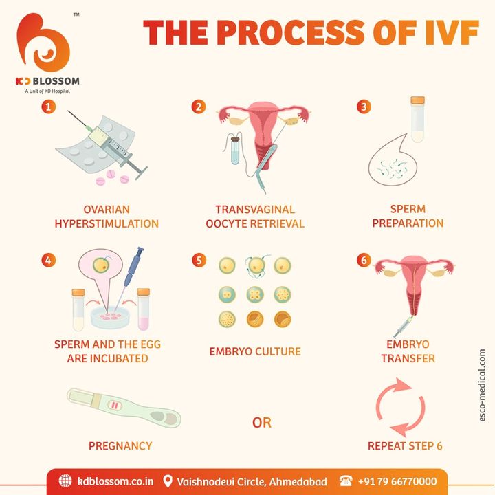 We are here with the  In vitro fertilization (IVF) complex series of procedures which involves the above steps with KD Hospital's Special IVF Package you can avail of free services like First Consultation, First USG Screening, Semen Analysis & Counselling. To book an appointment, give us a call now: +91 9925324442. 
Offer valid till 31st August'21 only.

#KDHospital #KDBlossom #ivf  #fertility #infertility  #fertilitydiet #miscarriage #hormones #wellness #infertilitysupport #nutrition #endometriosis #infertilityjourney #family  #iui #infertilityawareness #infertilitysucks #fertilityawareness #love #pregnant #health #ivfjourney #baby  #womenshealth #pcos #fertilityjourney #pregnancy #Ahmedabad #Gujarat #India