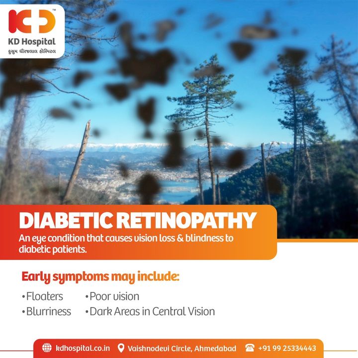 Patients suffering from diabetes are the victims of Diabetic Retinopathy.  
A medical diagnosis for mild & advanced cases is necessary. Mild cases, with careful diabetes management, can be cured.
To check on your status Call Now: +91 9925334443 & book your Free consultation. Valid till 30th Nov'21 only.

#KDHospital #Diabeticretinopathy #EyeCheckUp #FreeEyeCheckUp #FreeEyeCamp #Blur #BlurryVision #DiabetesAwarenessMonth #eye #eyedoctor #retina #eyes  #eyevision #diabetes #medical #medicine  #healthcare #hospital #vision #lens #eyeglasses #eyewear #health #wellness #wellnessthatworks #Ahmedabad #Gujarat #India