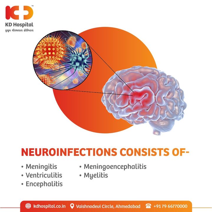 Neuroinfections is caused when virus, bacteria or fungus attack the brain & or spinal cord to muscles & nerves system. 
The effects can range from mild illness to serious impairment also can prove fatal as well.
Despite advances in therapy and the development of early detection techniques, many of the affected patients can undergo severe conditions, chronic & and even life threatening problems. 
 Visit the expert to get perfect diagnosis & proper treatment.

#KDHospital #Neuroinfections #paralysis #Parkinson #Alzheimer #dementia #stressfreelife  #intakeofdrugs #healthylife #mentallyhapy #physicallyfit #doctor #health #healthcare #hospital #doctors #physicalcare #mentalcare #healthylifestyle #medlife #goodhealth #health #fitness #healthyliving #patientscare #Ahmedabad