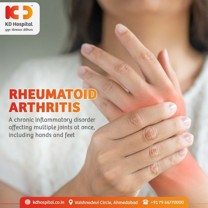 In Rheumatoid Arthritis the lining of the joints are affected, leading to painful swelling. This can cause long-lasting or chronic pain in the joints. A lack of balance, unsteadiness and deformity are often noticeable. Ensure your visit to KD Hospital to receive expert treatments & relive a healthy life.

#KDHospital #RheumatoidArthritis #affordablequalityservices #stressfreelife #intakeofdrugs #healthylife #mentallyhappy # physicallyfit #doctor #health #healthcare #hospital #doctors #physicalcare #mentalcare #healthylifestyle #medlife #goodhealth #health #fitness #healthyliving #patientscare #Ahmedabad #yourstomake