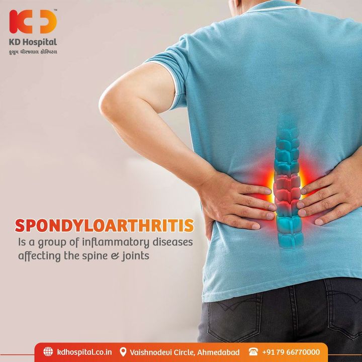 Spondyloarthritis is characterized by inflamed Spine (spondylitis) and joints (arthritis). The leading symptom is lower back pain. Some patients also complain of painful arms and legs. Complications include heart disease and intestinal inflammation. Visit us for the best medical treatment under expert doctors for a healthy life.

 #KDHospital #Spondyloarthritis #affordablequalityservices #stressfreelife #intakeofdrugs #healthylife #mentallyhappy # physicallyfit #doctor #health #healthcare #hospital #doctors #physicalcare #mentalcare #healthylifestyle #medlife #goodhealth #health #fitness #healthyliving #patientscare #Ahmedabad #yourstomake