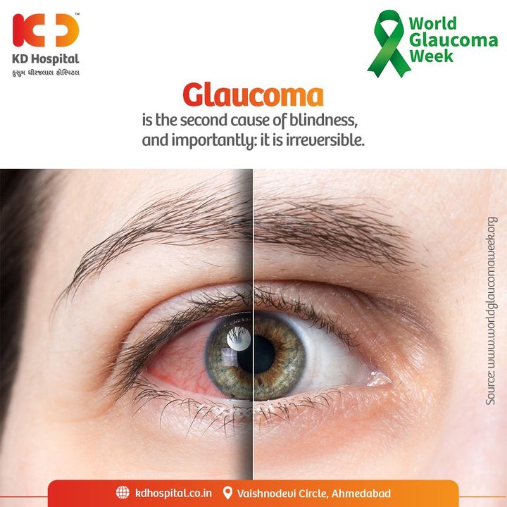 Take care of your eyesight and stay away from Glaucoma with regular checkups and precautions.KD Hospital is offering Free Consultation & Screening (for Glaucoma patients only). Visit us between 1st to 12th March'22 to avail this offer.
For appointments call us on +91 89802 80802.

#KDHospital #NABHHospital #GlaucomaAwareness #LowVision #HealthyEye #Doctors #Safety #Ophthalmology #eyecheckup #cataract #vision #eyecare #eyedoctor #eyes #eyespecialist #glasses #eyeclinic #eyehealth #health #cataractsurgery #wellness #goodhealth #wellnessthatworks #Nusring #QualityCare #hospitals #healthcare #Ahmedabad #Gujarat #India