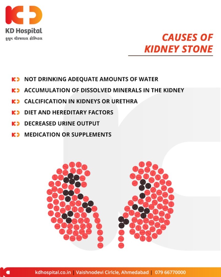 #KidneyStones are slowly becoming a #lifestyle disease! Let's see the causes & the preventive care for these!

#KDHospital #GoodHealth #Ahmedabad #Gujarat #India