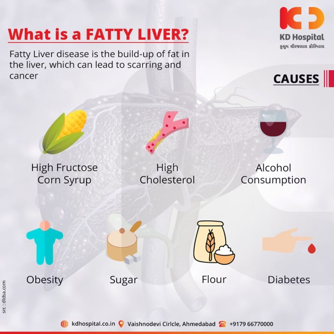 Fatty liver is also known as hepatic steatosis. It happens when fat builds up in the liver.

For appointment call: +91 79 6677 0000

#KDHospital #goodhealth #health #wellness #fitness #healthy #healthiswealth #wealth #healthyliving #joy #patientscare #Ahmedabad #Gujarat #India