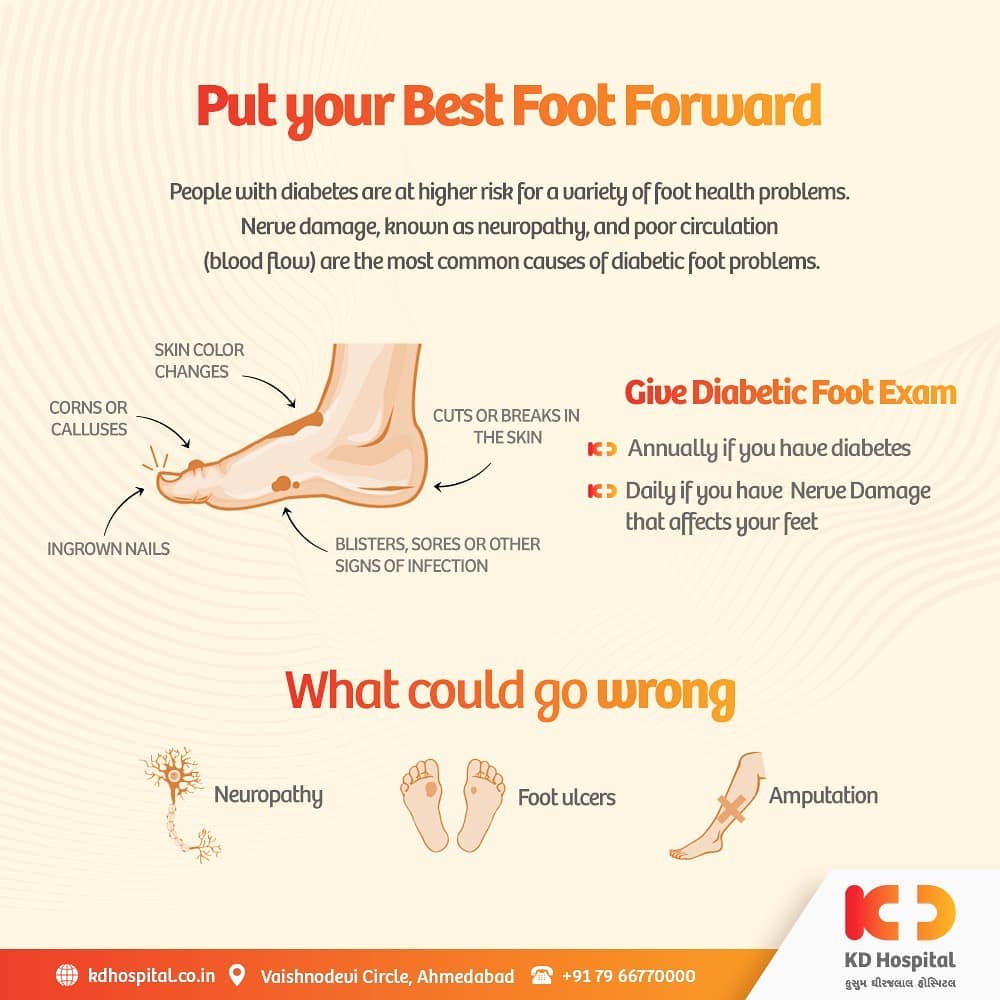 A diabetic foot exam checks individuals with diabetes for dissimilar changes in their skin, nails of feet or sensation on the surface of feet. Book an appointment with us on +91 9825 9933 35 for Complete Diabetes Screening. 

#KDHospital #diabetes #diabetesscreening #diabetesawareness #diabetestype1 #diabetestype2 #diabetescommunity #DiabeticFootExam #goodhealth #healthiswealth #healthyliving #patientscare #StayAware #StaySafe #Doctors #DoctorsOfInstagram #Diagnosis #Therapeutics #socialmediamarketing #digitalmarketing #pandemic #Ahmedabad #Gujarat #India