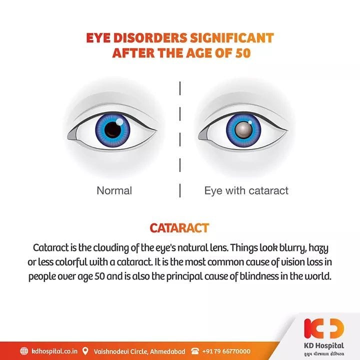 Cataract is the most accountable cause of world blindness (51%), depicting about 20 million people worldwide. Early treatment of cataract can help prevent the blindness on a long run. 

KD Hospital is having a free eye consultation from 17/11/2020 to 30/11/2020 for the patients above the age of 50. Call +918980280802 or +916359603634 between 9:00 AM to 5:00 PM to book an appointment. Additionally, we have Cashless Facilities available at the hospital. 

#KDHospital #eyecheckup #cataract #blindness #blind #cataractsurgery #blindnessawareness  #DoctorsOfInstagram #Diagnosis #Therapeutics #goodhealth #pandemic #socialmedia #socialmediamarketing #digitalmarketing #wellness #wellnessthatworks #Ahmedabad #Gujarat #India