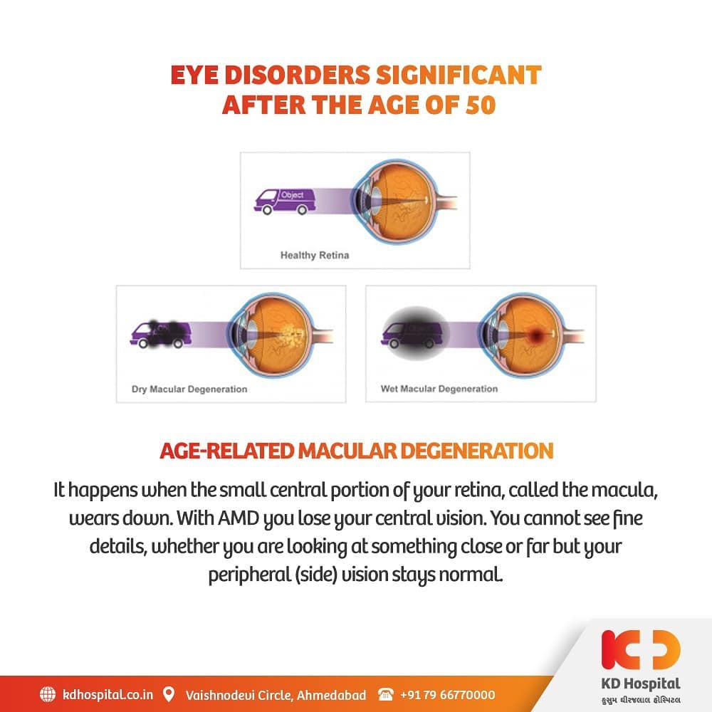 Age-Related Macular Degeneration is an eye disorder that blurs one's sharp, central vision which is required for daily chores like reading or driving. 

KD Hospital is having a free eye consultation from 17/11/2020 to 30/11/2020 for the patients above the age of 50. Call +918980280802 or +916359603634 between 9:00 AM to 5:00 PM to book an appointment. Additionally, we have Cashless Facilities available at the hospital.

#KDHospital #eyecheckup #ARMD #MacularDegeneration #blindness #blind #cataractsurgery #blindnessawareness #DoctorsOfInstagram #Diagnosis #Therapeutics #goodhealth #pandemic #socialmedia #socialmediamarketing #digitalmarketing #wellness #wellnessthatworks #Ahmedabad #Gujarat #India