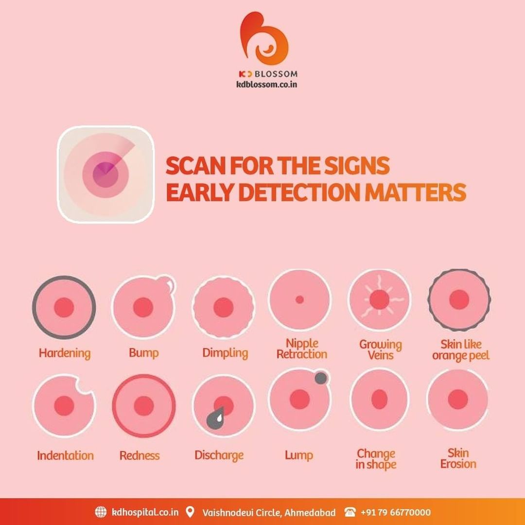 Regular Breast Self-Examination (BSE) not only screens for possible irregularities, but also helps to detect the possibility of breast cancer. We all should take up BSE at least once a month.
#KDHospital #KDBlossom #breastcancerawareness #breastcancer #breastcancersurvivor  #Cancer #CancerFree #cancersurvivor #breastcancerfighter #breastcancerjourney #StayAware #StayAwareStaySafe  #Diagnosis #goodhealth #pandemic #socialmedia #socialmediamarketing #digitalmarketing #wellness #wellnessthatworks #Ahmedabad #Gujarat #India