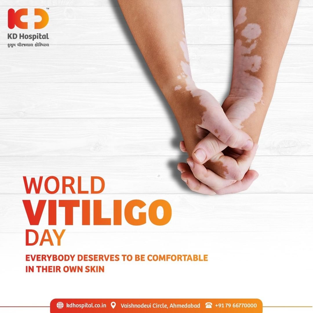 World Vitiligo Day is an initiative that aims to build global awareness about Vitiligo.

#KDHospital #Vitiligo #WorldVitiligoDay #SkinDisease #Diagnosis #Therapeutics #Awareness #wellness #goodhealth #wellnessthatworks #Nusring #NABHHospital #QualityCare #hospitals #healthcare #physicians #explore #surgeon #Ahmedabad #Gujarat #India