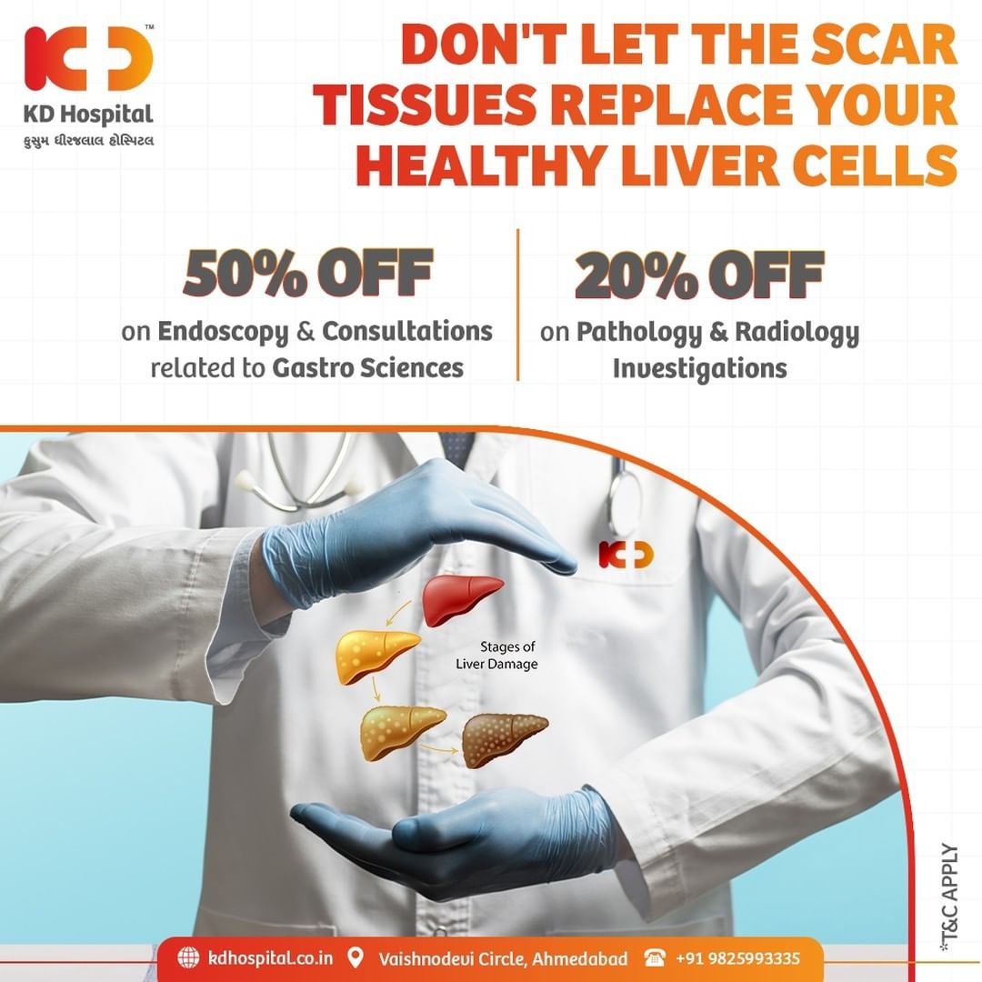 Hepatic cirrhosis causes chronic liver damage leading to scarring and liver failure. Don't let your liver get sick and avail consultation on your GI tract related problems now. 
Call +919825993335 to book an appointment with us.

#KDHospital #GastroSciences #GastroEnterology #GastroSurgery #LiverDiseases #Safety #PatientSafety #SafetyComesFirst #SafetyFirst #SafetyMeasures #Diagnosis #Therapeutics #Awareness #wellness #goodhealth #wellnessthatworks #Nusring #NABHHospital #QualityCare #hospitals #healthcare #physicians #surgeon #Ahmedabad #Gujarat #India