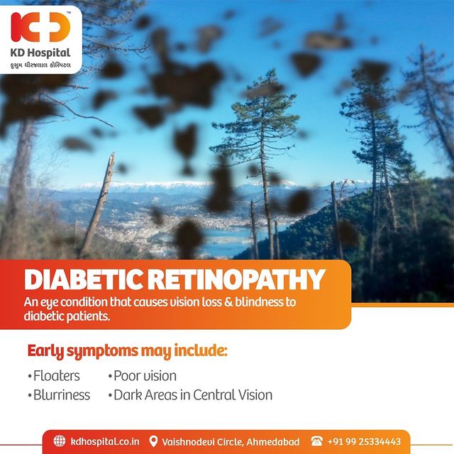 Patients suffering from diabetes are the victims of Diabetic Retinopathy. 
A medical diagnosis for mild & advanced cases is necessary. Mild cases, with careful diabetes management, can be cured.
To check on your status Call Now: +91 9925334443 & book your Free consultation. Valid till 30th Nov'21 only.

#KDHospital #Diabeticretinopathy #EyeCheckUp #FreeEyeCheckUp #FreeEyeCamp #Blur #BlurryVision #DiabetesAwarenessMonth #eye #eyedoctor #retina #eyes  #eyevision #diabetes #medical #medicine #health #healthcare #hospital #vision #lens #eyeglasses #eyewear #health #wellness #wellnessthatworks #Ahmedabad #Gujarat #India