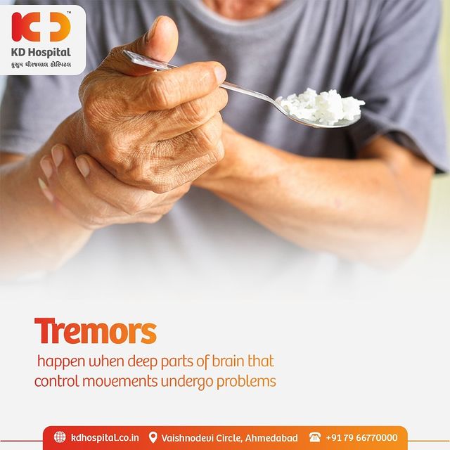 Tremors lead to shaking movements in one or more parts of the body. It mostly affects hands, but sometimes can affect vocal chords, head& legs as well. Tremors have no known cause, but inheritance & in-family causes are on the list. To avoid it, one must cope up with tremors by trying to check on the reason and working against it. Try to stay stress free & mentally happy & healthy. 
Visit your doctor for a perfect stress-free, healthy life.

#KDHospital  #Tremors #stressfreelife #healthylife #mentallyhapy #physicallyfit #doctor #health #healthcare #hospital #doctors #physicalcare #mentalcare #healthylifestyle #medlife #goodhealth #health #fitness #healthyliving #patientscare #Ahmedabad #Gujarat