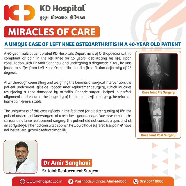 Here is the story of a 40-year-old male patient who suffered from knee pain for 15 years and has successfully been treated at KD Hospital, Ahmedabad. Admitted under the care of Dr Amir Sanghavi, Senior Joint Replacement Surgeon, he underwent a Robotic knee replacement surgery that helped relieve his longstanding pain & restore altered mobility.

#KDHospital #miraclesofcare #osteoarthritis #Arthritis #kneepainrelief #knee #joint #OrthopaedicSurgery #Doctors #hospital #doctor #surgery #orthopedics  #orthopaedics #totalkneereplacement #sportsmedicine #robotickneereplacement #kneereplacementsurgey #kneesurgery #WellnessThatWorks #healthyliving #YoursToMake #trendinginahmedabad #Ahmedabad #Gujarat #india