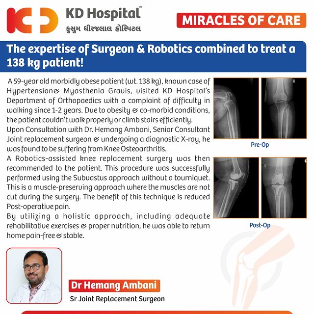 The life of a 59-year-old obese patient had come to a standstill due to severe difficulty in walking. Dr Hemang Ambani, Senior joint replacement Surgeon was able to treat his knee osteoarthritis at KD Hospital with expert precision using Robotic-assisted knee replacement surgery. This case highlights the importance of less invasive & modern treatment modalities for a better outcome.

#KDHospital #miraclesofcare  #OrthopaedicSurgery #Doctors #hospital #surgery #orthopedics #robot #orthopaedics #totalkneereplacement  #subvastus  #Lessinvasivesurgery #kneereplacement #TKR #happypatient #minimallyinvasivekneereplacement #bleedingcontrol #tourniquet  #myastheniagraviswarrior #myastheniagravis #autoimmune  #robotickneereplacement #kneereplacementsurgey #kneesurgery #interactivegrams #instagrameverywhere #YoursToMake  #Gujarat #india