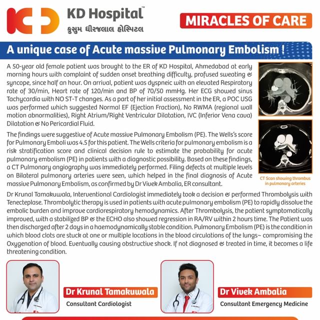 The life of a 50-year-old woman, with a massive pulmonary embolism, was saved by the experts at KD Hospital, Ahmedabad.
A female patient came to the ER in a critical condition with breathing difficulty & profused sweating. Upon diagnostic investigations, it was confirmed by Dr Vivek Ambalia (Consultant Emergency Medicine) that she was suffering from an Acute massive Pulmonary Embolism. Dr Krunal Tamakuwala (Interventional Cardiologist) then performed a Thrombolysis procedure & saved her life. 
@drkrunaltamakuwala @vivekambalia 
#KDHospital #miraclesofcare #thrombolysis #ctscan #wellsscore #pulmonary #embolism #PE #pulmonaryangiography #health #cardio #heart #hospital #healthcare #heartattack #hearthealth #cardiology #heartdisease #interventionalvardiology #emergencymedicine #filingdefects #surgery  #YoursToMake #Ahmedabad #Gujarat #india