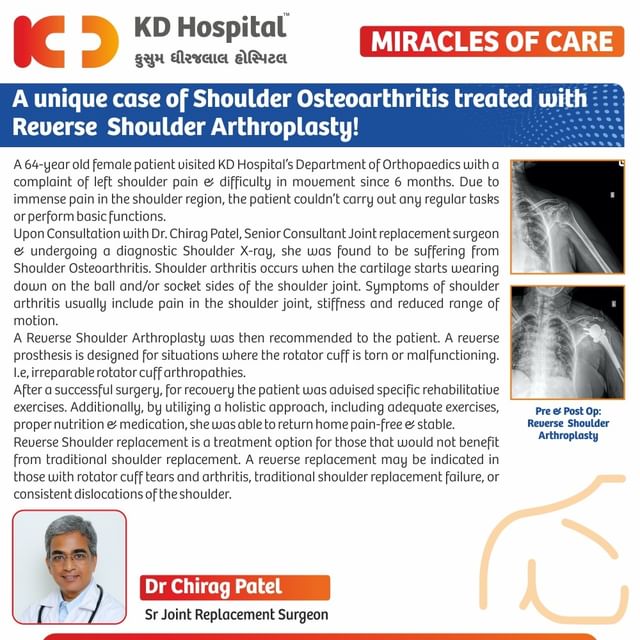 Using Reverse Shoulder Arthroplasty to treat a case of Shoulder Osteoarthritis in a 64-year-old patient.
 A female patient came to KD Hospital as she was suffering from severe shoulder pain & difficulty in the movement since 6 months. Upon thorough consultations & diagnostic X-ray, Dr Chirag Patel, Senior Joint Replacement Surgeon performed a Reverse Shoulder Arthroplasty on the patient. With help of this surgery & rehabilitative exercises, the patient went home in a stable condition.

#KDHospital #healthcare #miraclesofcare  #reverseshoulderarthroplasty #shoulderarthroplasty #arthroplasty #osteoarthritis #shoulderpain #arthropathy #rotatorcuff #implant #bones #bonesurgery #surgery #doctor #hospital #surgery #joint #trauma #knee #hip #ortho #sportsmedicine #orthopedics #surgical #orthopedic #fracture #trendinginahmedabad #Ahmedabad #Gujarat #india