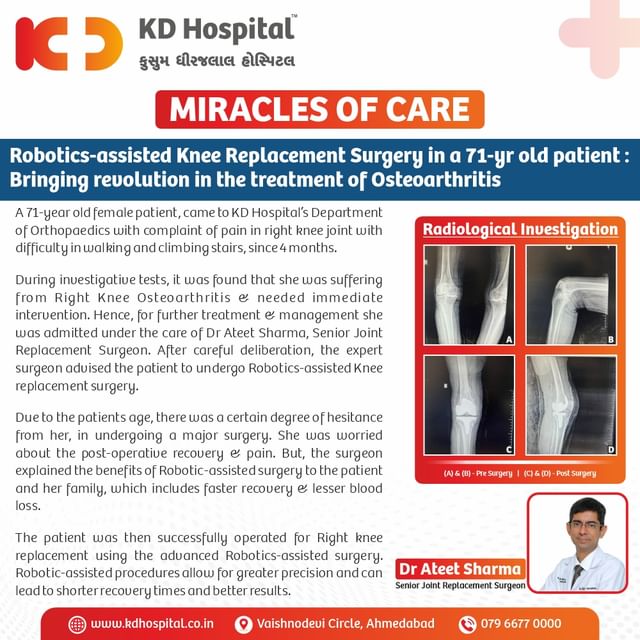 A Robotics-Assisted Knee Replacement Surgery was performed seamlessly on a 71-yr old female patient, by Dr Ateet Sharma, Senior Joint Replacement Surgeon at KD Hospital.
This advanced surgery has been proven to be the best option in cases when the traditional surgical procedure would have a high risk of failure.
Post-Surgery the patient was extremely happy & was able to walk without any difficulty.

@dr.ateetsharma 

#KDHospital #miraclesofcare #OrthopaedicSurgery #Doctors #hospital #surgery #orthopedics #robot #orthopaedics #totalkneereplacement #subvastus #Lessinvasivesurgery #kneereplacement #TKR #happypatient #minimallyinvasivekneereplacement #bleedingcontrol #tourniquet #myastheniagraviswarrior #myastheniagravis #autoimmune #robotickneereplacement #kneereplacementsurgey #kneesurgery #interactivegrams #instagrameverywhere #YoursToMake #Gujarat #india