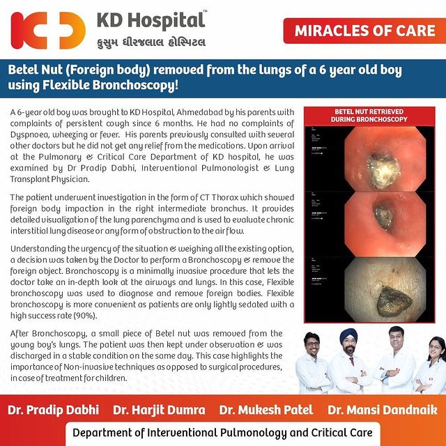 KD Hospital's Pulmonary & Critical Care team expertly treated a 6-year-old boy, who had betel nut lodged in his airways for the last 6 months.
Dr Pradip Dabhi, Interventional Pulmonologist & Lung Transplant Physician performed a Flexible Bronchoscopy to remove a small piece of foreign body from the airways of a small boy. This case highlights the importance of minimally invasive techniques for the pulmonary treatment of children.

#KDHospital  #miraclesofcare #BestMultispeacialityHospital #Hi5KD #5yearsofhealingKD  #bronchoscopy #foreignbody #betelnut #interventionalpulmonology #lung #thorax #pulmonology #respiratorytherapy #heathcareworkers #pulmonologist #lungsspecialist #interventionalpulmonologist #copd #health #doctor #nurse #breathe #hospital #medical #healthcare #asthma #physician #radiology #lungs #internalmedicine