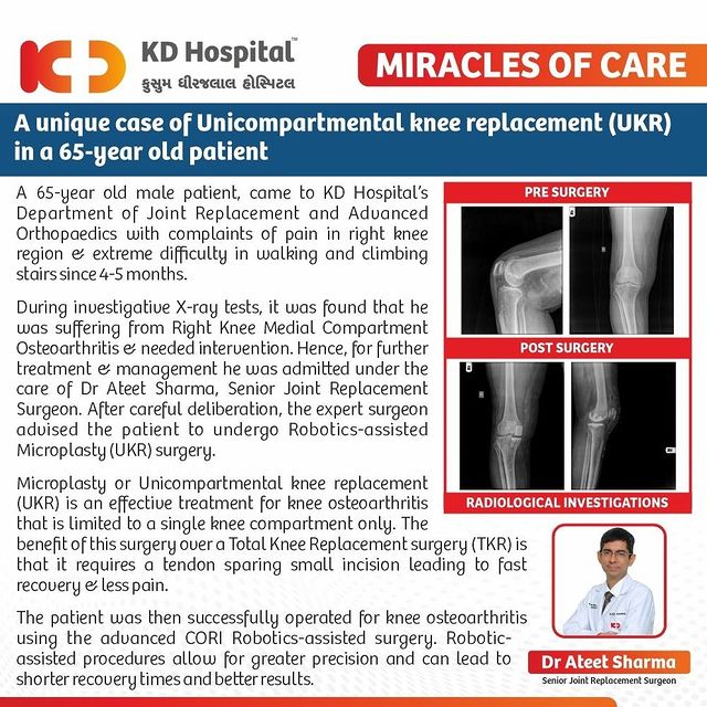 Knee osteoarthritis in a 65-year-old patient treated expertly with Robotics-assisted Microplasty (UKR) surgery.

A 65-year-old male patient with knee pain & difficulty in walking & climbing stairs came to KD hospital for treatment. Diagnostic tests showed that he was suffering from Right Knee Medial Compartment Osteoarthritis & needed surgical intervention. Under the care of Dr Ateet Sharma, Senior Joint Replacement Surgeon, he was treated with Robotics-assisted Microplasty (UKR) surgery. Compared to a Total Knee Replacement (TKR), this surgery requires a smaller incision that spares the tendon, resulting in a faster recovery & lesser pain.

#KDHospital  #miraclesofcare #OrthopaedicSurgery  #Hi5KD #5yearsofhealingKD #jointreplacement #besthospital #totalkneereplacement #corisurgicalsystem #robot #robotics #kneesurgery #knee #ortho #kneepain #jointpain #orthopedics #orthopedicsurgery #physicaltherapy #sportsmedicine #kneepain #ortho #orthopedicsurgeon #orthopaedics #orthopedic #WellnessThatWorks #trendinginahmedabad #wellness #Ahmedabad #Gujarat #india