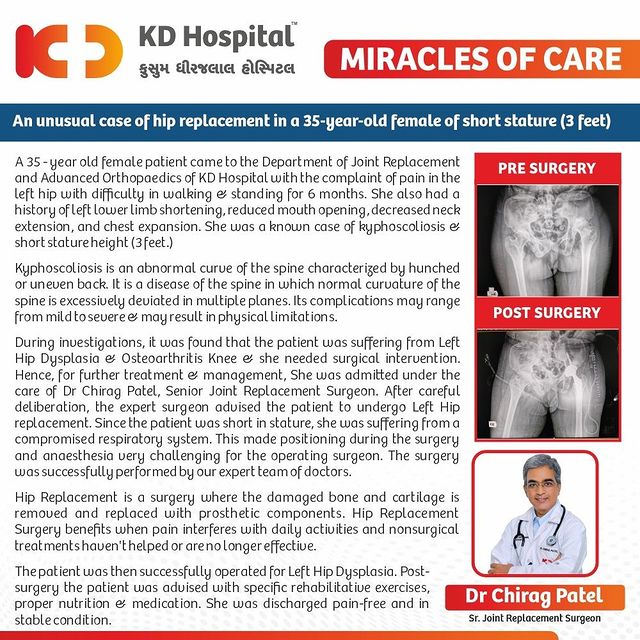 A 35-year-old female patient suffering from pain in the left hip with difficulty in walking & standing came to KD Hospital for treatment. Investigations showed that she suffered from Left Hip Dysplasia & Osteoarthritis Knee & needed surgical intervention. She was admitted under Dr Chirag Patel, Senior Joint Replacement Surgeon and treated successfully with Hip Replacement Surgery.

#KDHospital #miraclesofcare #OrthopaedicSurgery #Hi5KD #5yearsofhealingKD #jointreplacement #besthospital #kdorthopedic #orthopedicahmedabad #kdhospitalreplacementsurgery #osteoarthritis #arthritis #chronicpain #osteoporosis #rheumatoidarthritis #fibromyalgia #health #pain #chronicillness #orthopedics #arthritisawareness #hipreplacement #jointreplacement #orthopedics #arthritis #orthopedicsurgery #hipsurgery #hipreplacementrecovery #orthopedicsurgeon #surgery #hippain