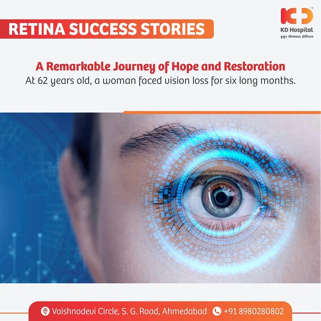 Witness the journey of a woman from Darkness to Light! 
A 62-year-old woman, battling vision loss for 6 long months, emerged victorious with a successful Type 1 closure of a large FTMH. 
In just 1.5 months post-op, her vision has remarkably improved to 6/12.

#KDHospital #VisionRestored #HopefulJourney #Inspiration #MedicalMiracle #SuccessStory #RetinaCare #Inspiration #EyeHealth #MedicalMiracle #retina #ophthalmology #glaucoma #eye #ophthalmologist #eyedoctor #eyes #cornea #optometry #eyecare #eyesurgery #optometrist #eyesurgeon #eyehealth #optician #cataractsurgery