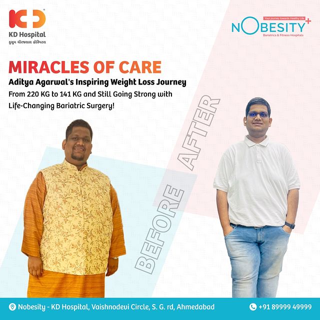 Witness the remarkable weight loss journey of Aditya Agarwal: From 220 KG to 141 KG post-bariatric surgery. If you're considering a similar path, remember, that you're never alone. KD Hospital and Dr. Manish Khaitan are here to support you every step of the way. 
Watch Aditya's inspiring transformation journey on YouTube now!

Tap the link to witness his incredible progress after bariatric surgery. 
https://www.youtube.com/watch?v=6d6zzk8Crrw

#KDHospital #NObesity #bariatric #bariatricsurgery #weightloss #weightlosssurgery #bariatriccommunity #weightlosstransformation #bariatriclife  #NobesityBariatric #WeightLoss #BariatricSurgery #BeatObesity