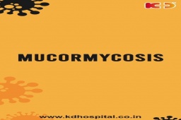 Did you know these facts about mucormycosis? If any of you or your relatives are having symptoms of Covid-19 related Black Fungus, call on +916359603633 to book an appointment with us.

#KDHospital #Mucormycosis #ReelItFeelIt #ReelsIndia